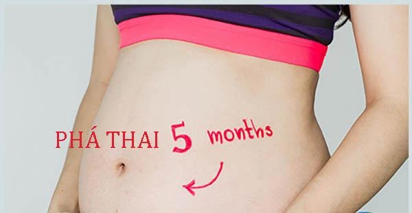 Thai 5 tháng tuổi có phá được không?