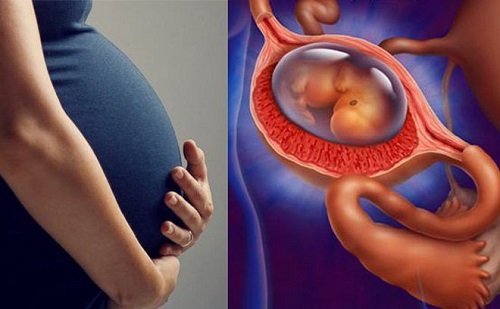 thai ngoài tử cung khi đặt vòng phải làm sao?