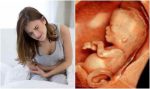 Dấu hiệu nhận biết thai chết lưu sớm trong bụng mẹ