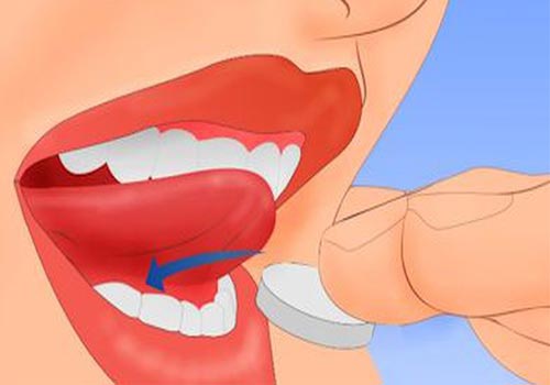 Thuốc phá thai ngậm dưới lưỡi là gì? Cách dùng thuốc phá thai viên ngậm